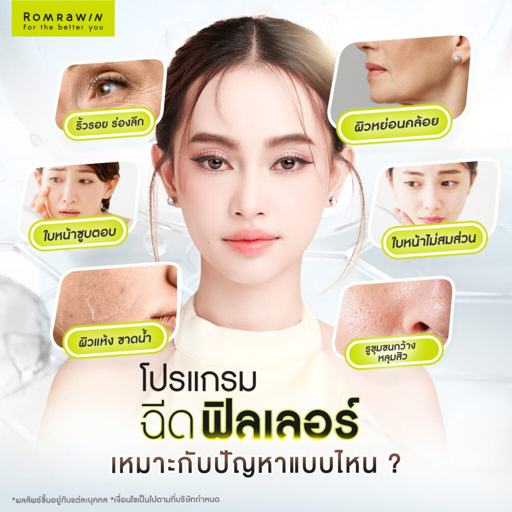 ปัญหาแบบไหน ควรฉีดฟิลเลอร์?