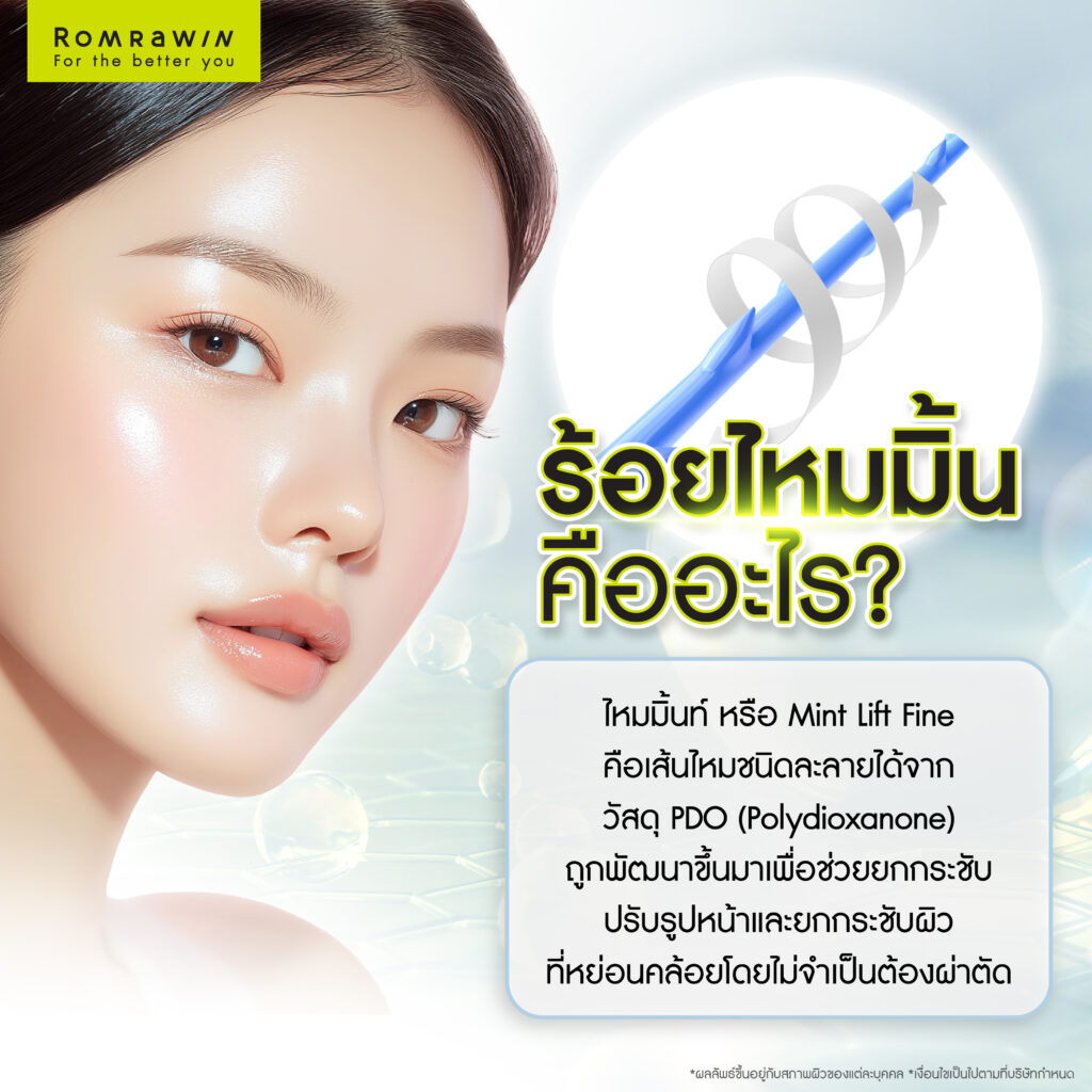 ร้อยไหม Mint Lift คืออะไร? ดีกว่าไหมทั่วไปอย่างไร? 2 ร้อยไหมมิ้นท์ คืออะไร?