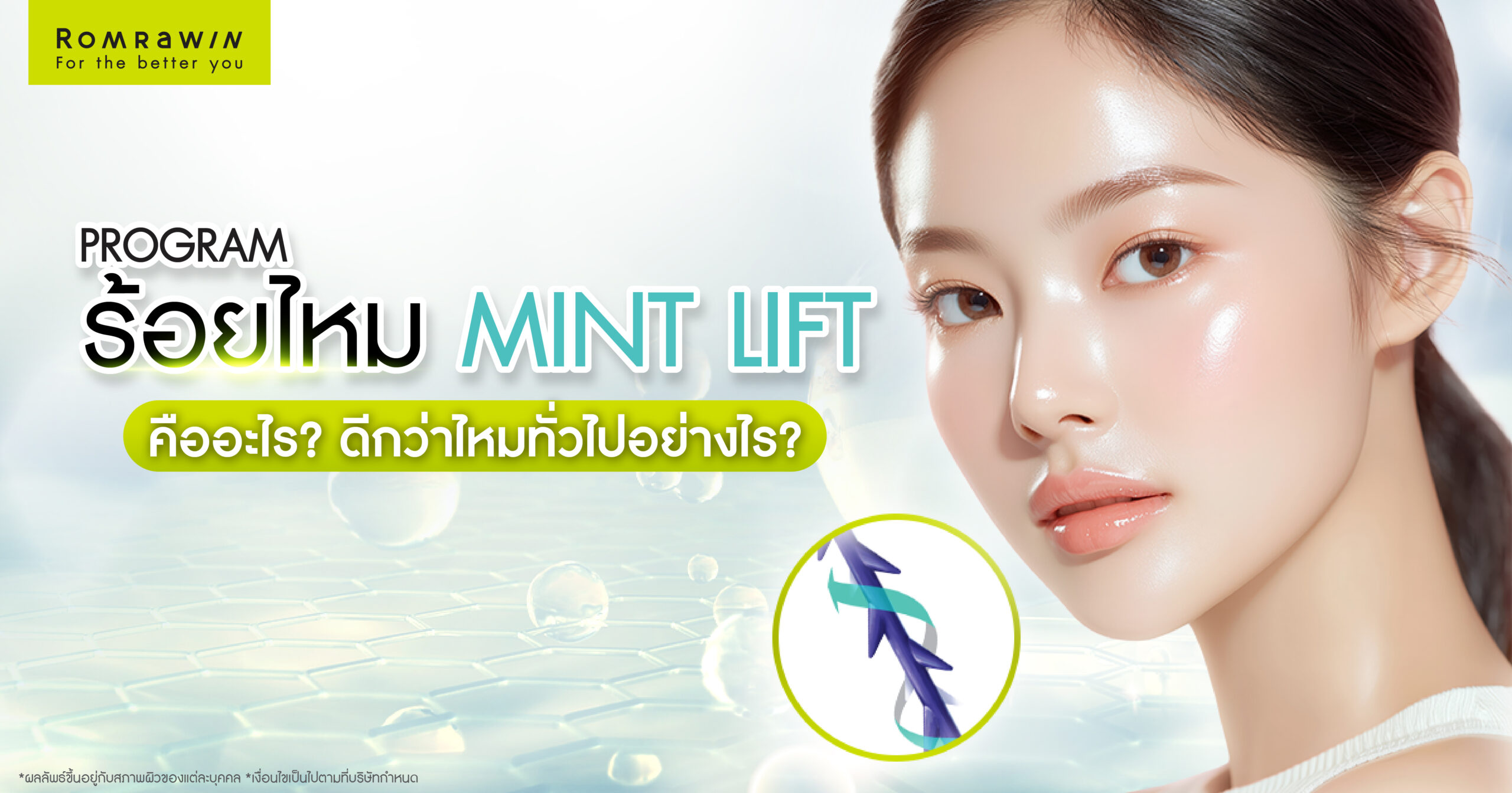 ร้อยไหม Mint Lift