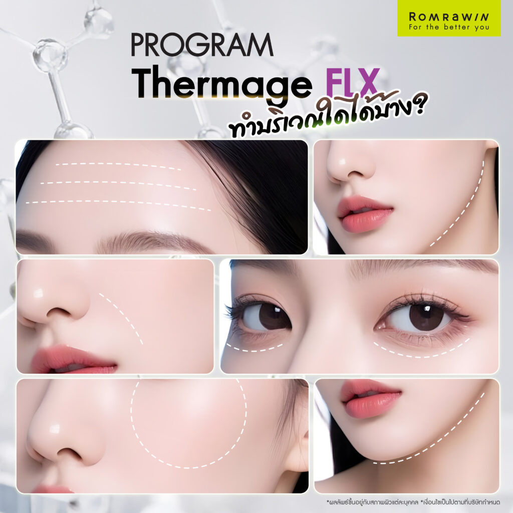 Thermage FLX สามารถทำบริเวณใดของร่างกายได้บ้าง?