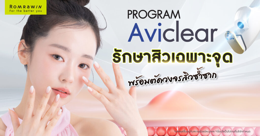 รักษาสิวเฉพาะจุด