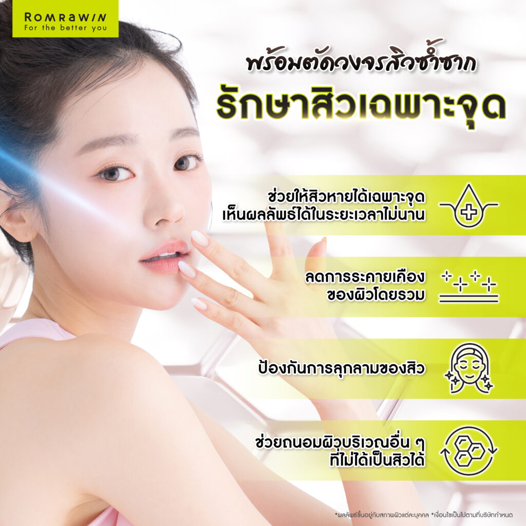ทำไมควรรักษาสิวเฉพาะจุด