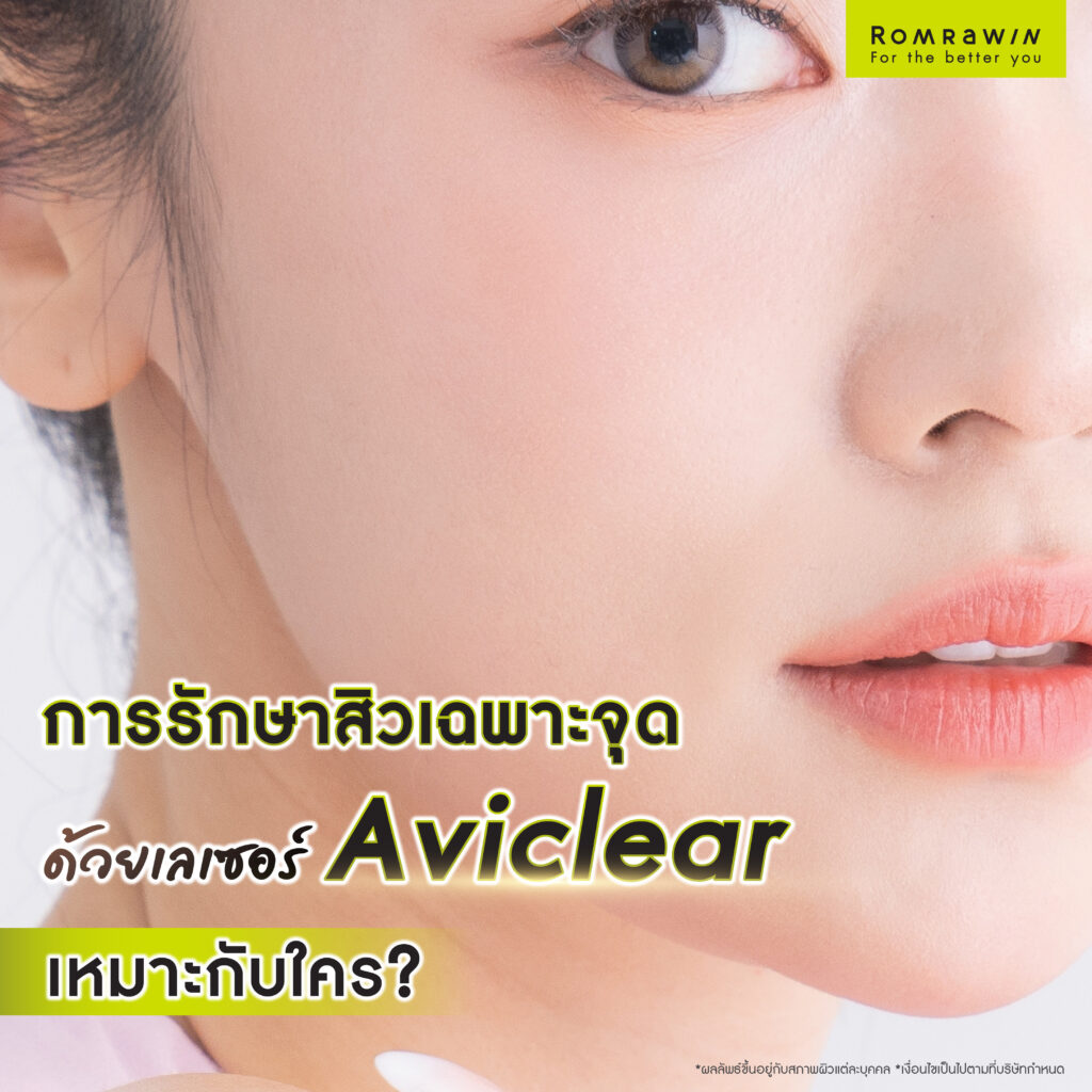 การรักษาสิวเฉพาะจุดด้วยเลเซอร์ Aviclear เหมาะกับใคร ?