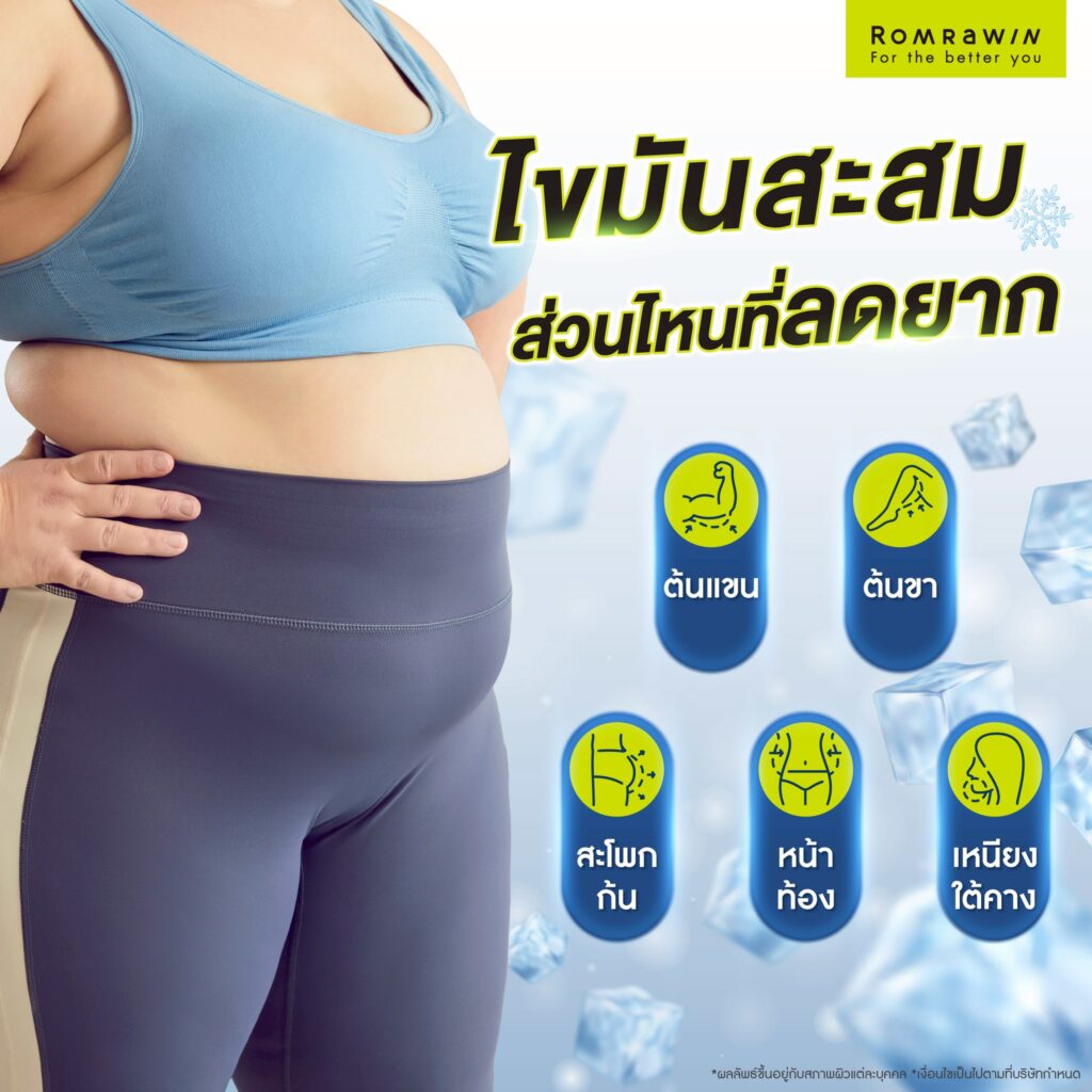 ไขมันสะสมส่วนไหน ที่ลดได้ยาก