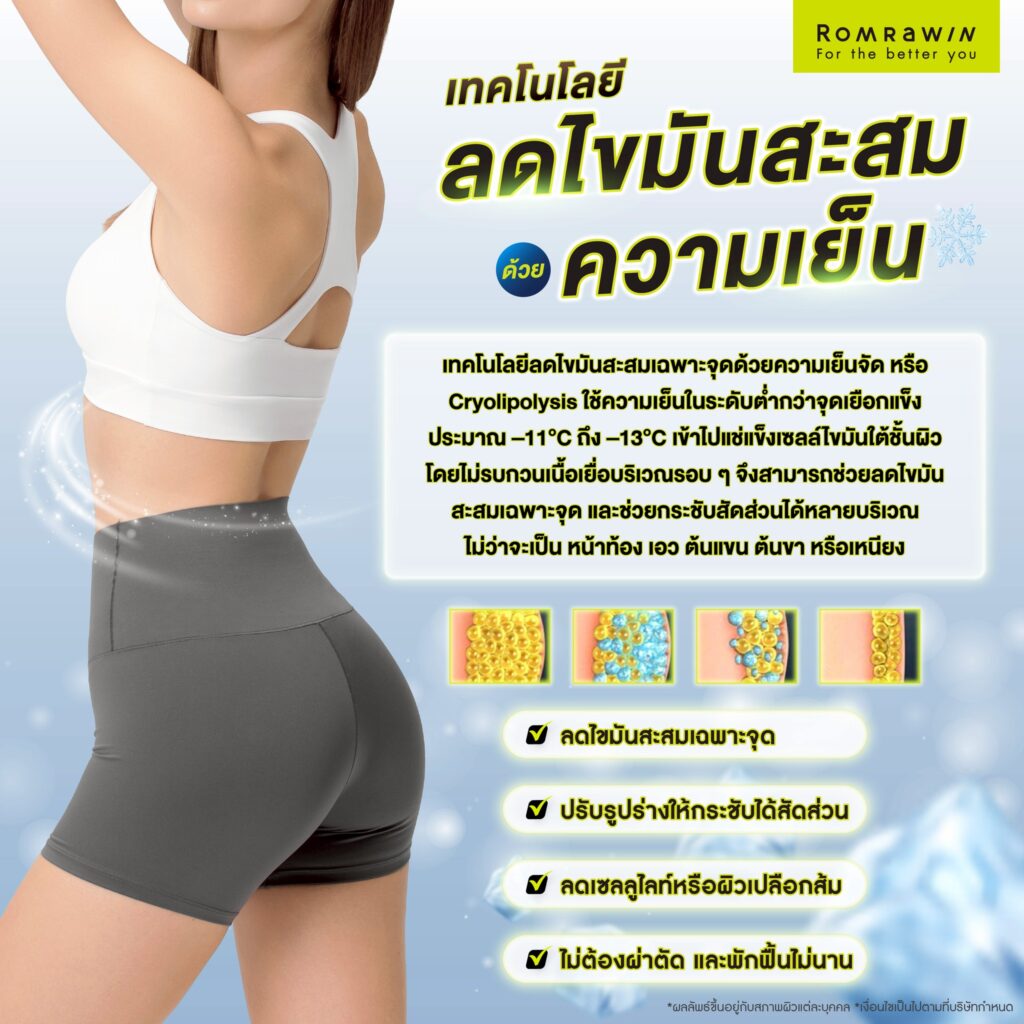 CoolSculpting เทคโนโลยีลดไขมันสะสมด้วยความเย็น