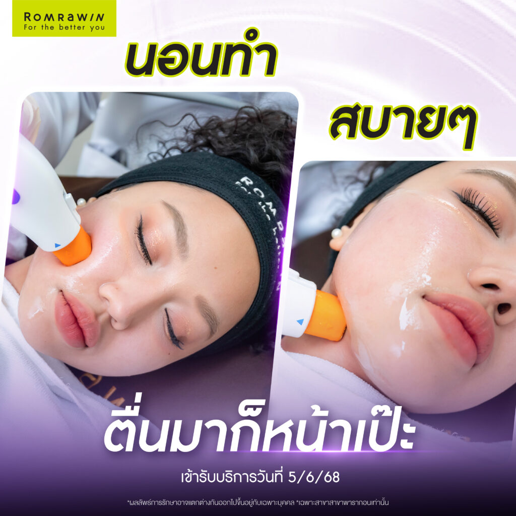 ยุบแก้มป่อง หน้าเรียวเหนียงหาย ไม่ต้องพึ่ง Contour โดยคุณกีตาร์ 3 ยุบแก้มป่อง หน้าเรียวเหนียงหาย ไม่ต้องพึ่ง Contour โดยคุณกีตาร์