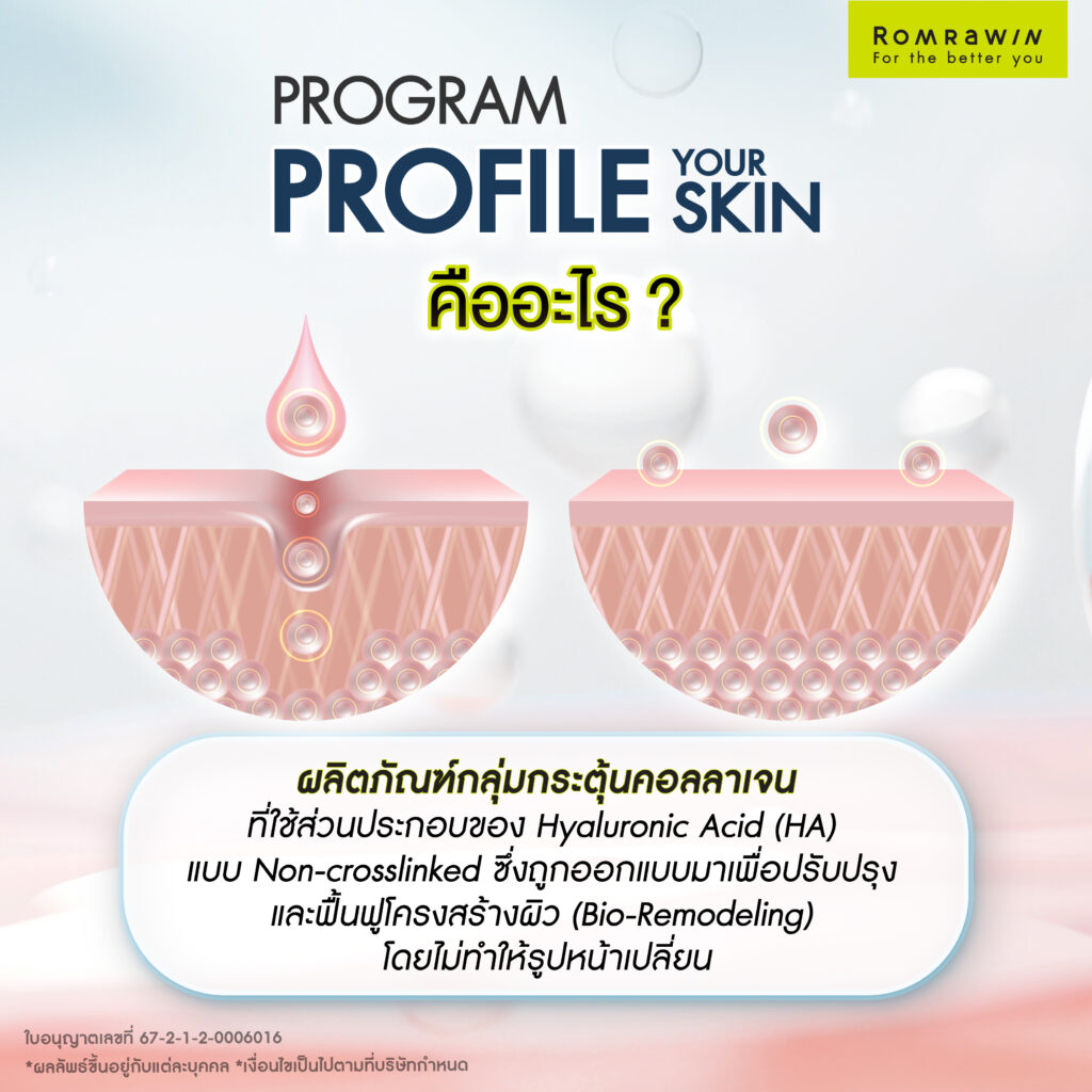 รู้จัก Profhilo กับ ฟิลเลอร์