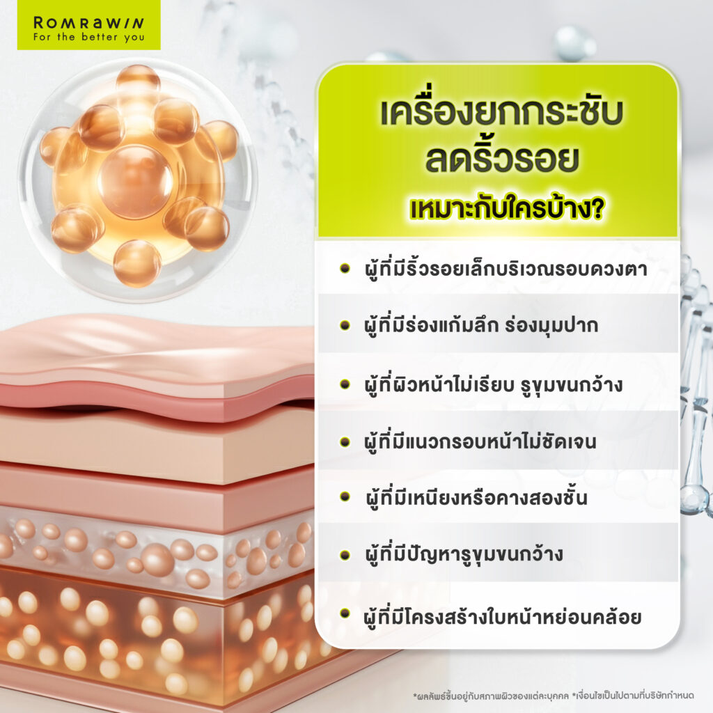 ริ้วรอยเกิดจากอะไร? แก้ปัญหาด้วยเครื่องยกกระชับลดริ้วรอยตัวไหนดี? 5 เครื่องยกกระชับลดริ้วรอย เหมาะกับใครบ้าง?