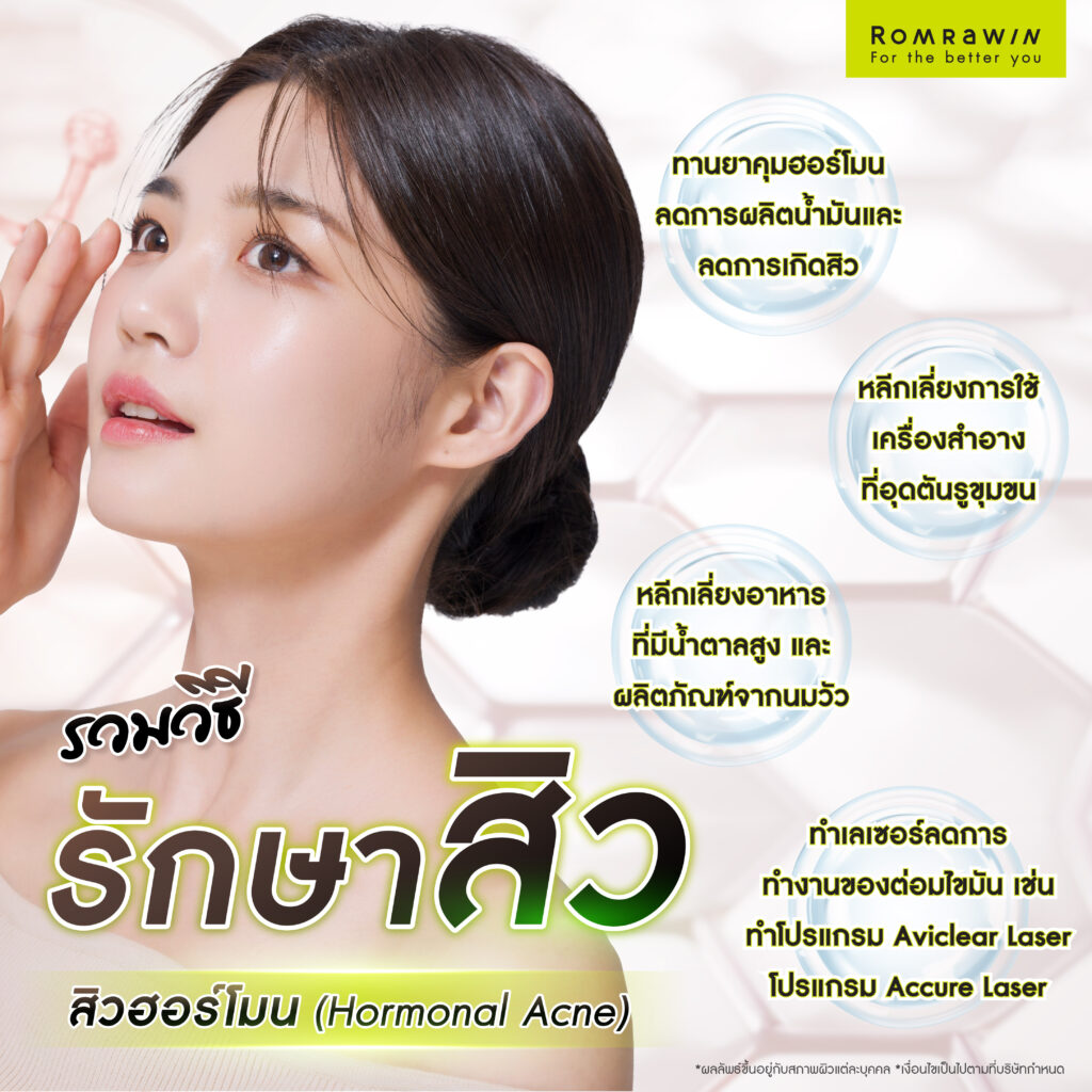 รวมวิธีรักษาสิวที่เหมาะกับสิวแต่ละประเภท 