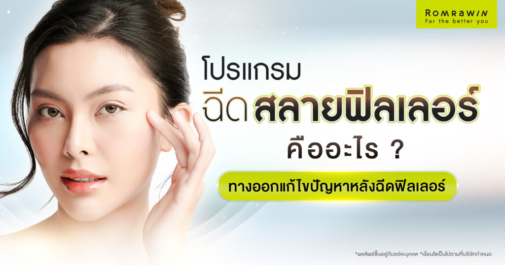 ฉีดสลายฟิลเลอร์