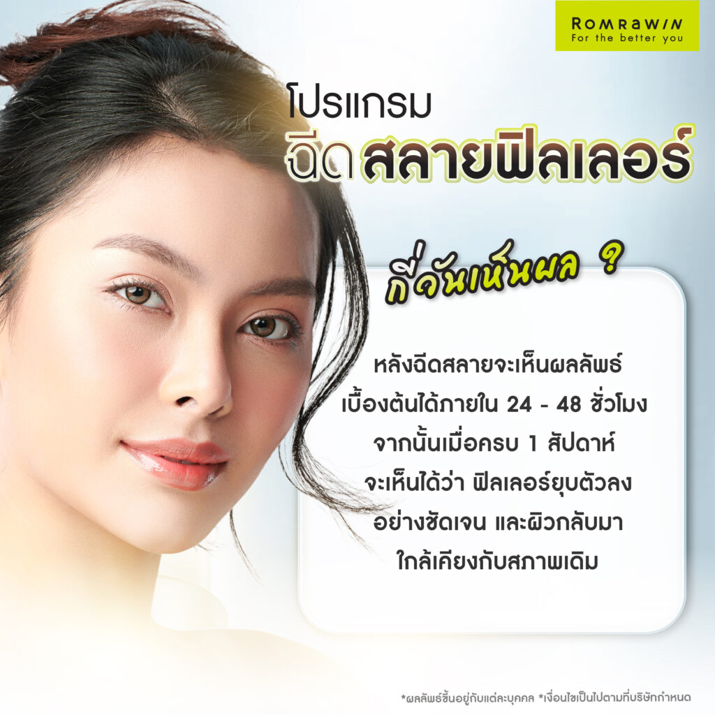 สลายฟิลเลอร์ คืออะไร? มีผลข้างเคียงไหม? ฉีดกี่วันเห็นผล? 6 ฉีดสลายฟิลเลอร์ กี่วันเห็นผล?