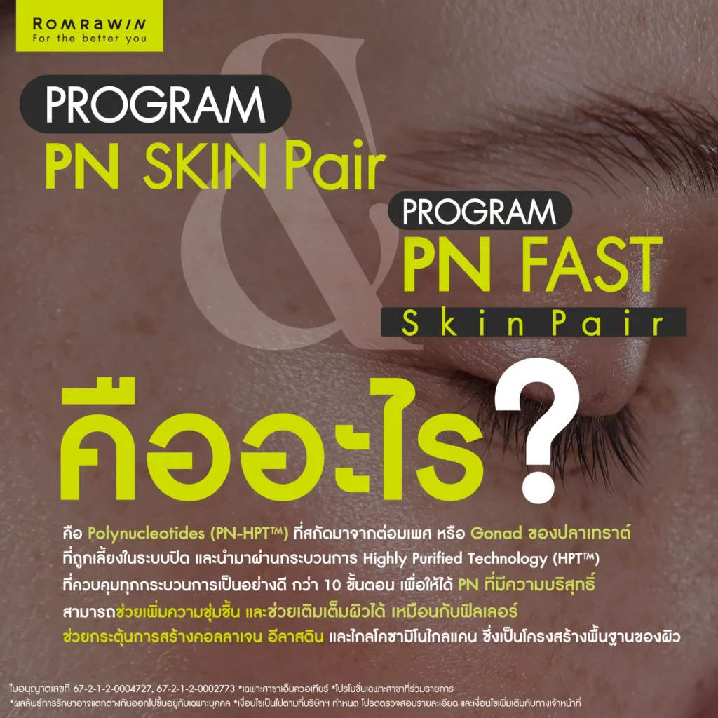Plinest คืออะไร ?