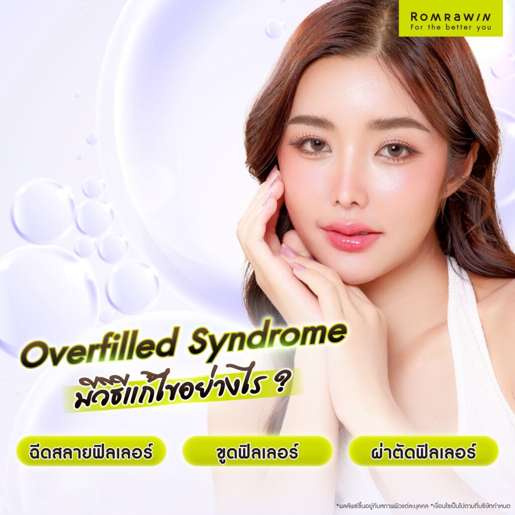 Overfilled Syndrome ภาวะหน้าล้นจากฟิลเลอร์ คืออะไร? เกิดจากอะไร? 3 Overfilled Syndrome มีวิธีแก้ไขไหม?