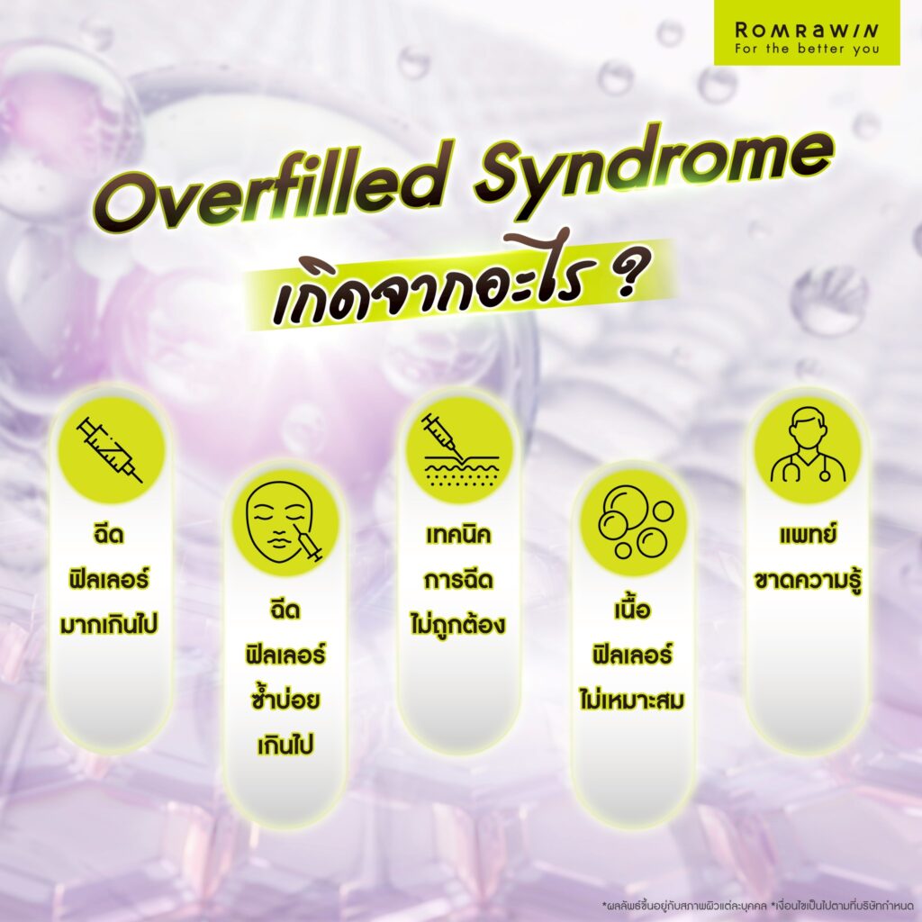 Overfilled Syndrome ภาวะหน้าล้นจากฟิลเลอร์ คืออะไร? เกิดจากอะไร? 2 Overfilled Syndrome เกิดจากอะไร?