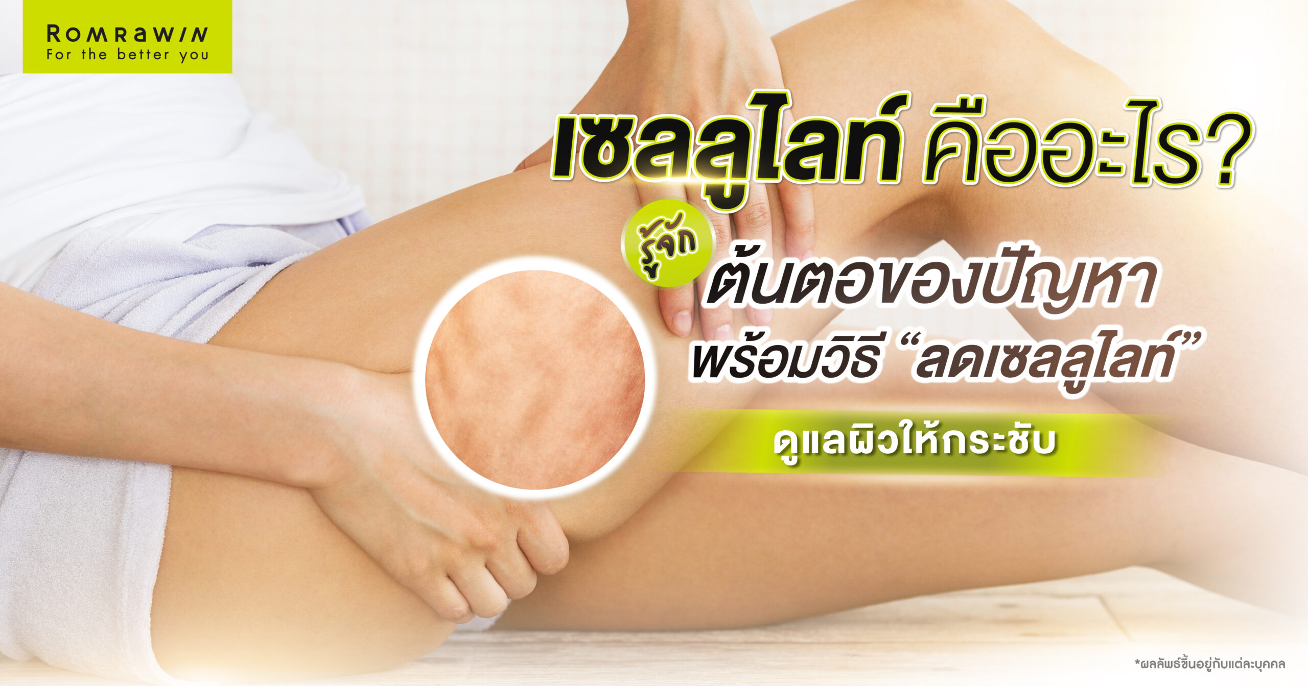 เซลลูไลท์ คืออะไร