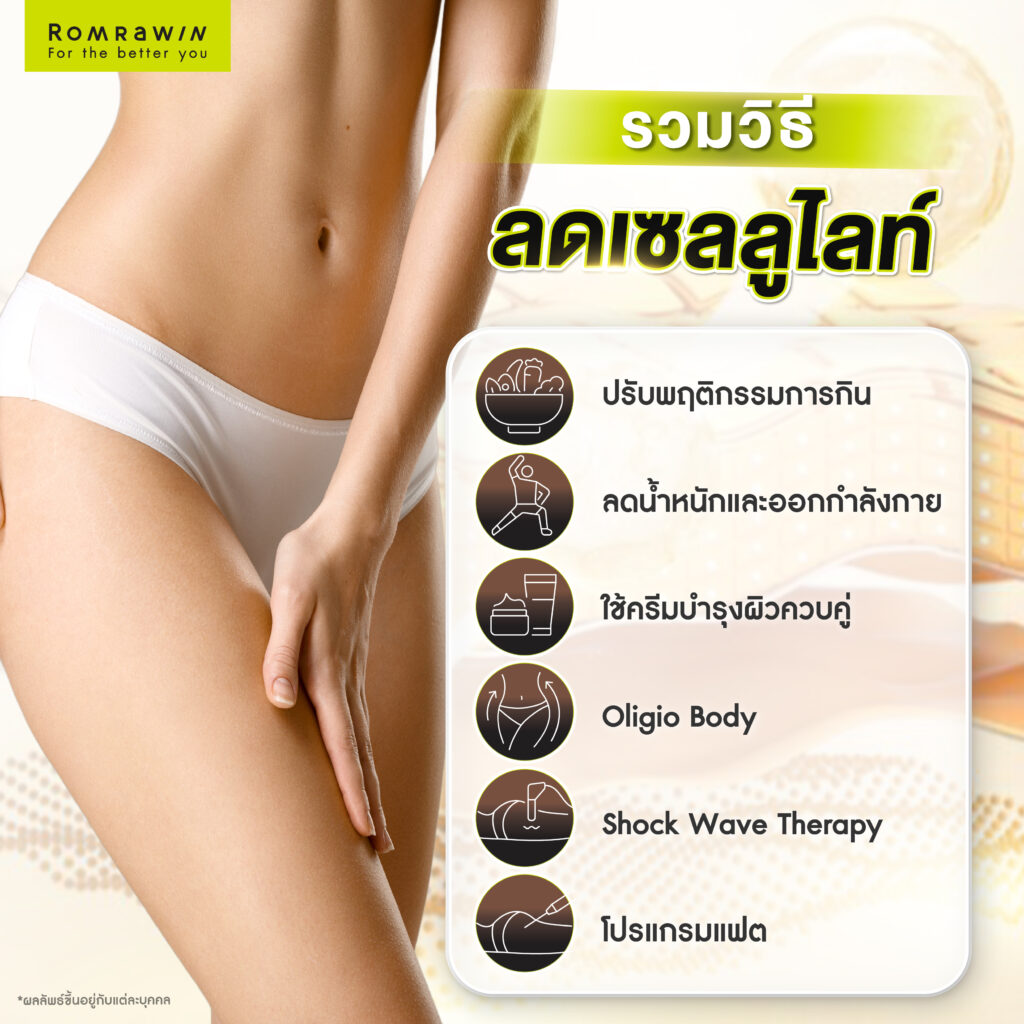 เซลลูไลท์ คืออะไร? รู้จักต้นตอของปัญหา พร้อมวิธีลดเซลลูไลท์ดูแลผิวให้กระชับ 4 วิธีลดเซลลูไลท์ด้วยตัวเอง ทำอย่างไร?