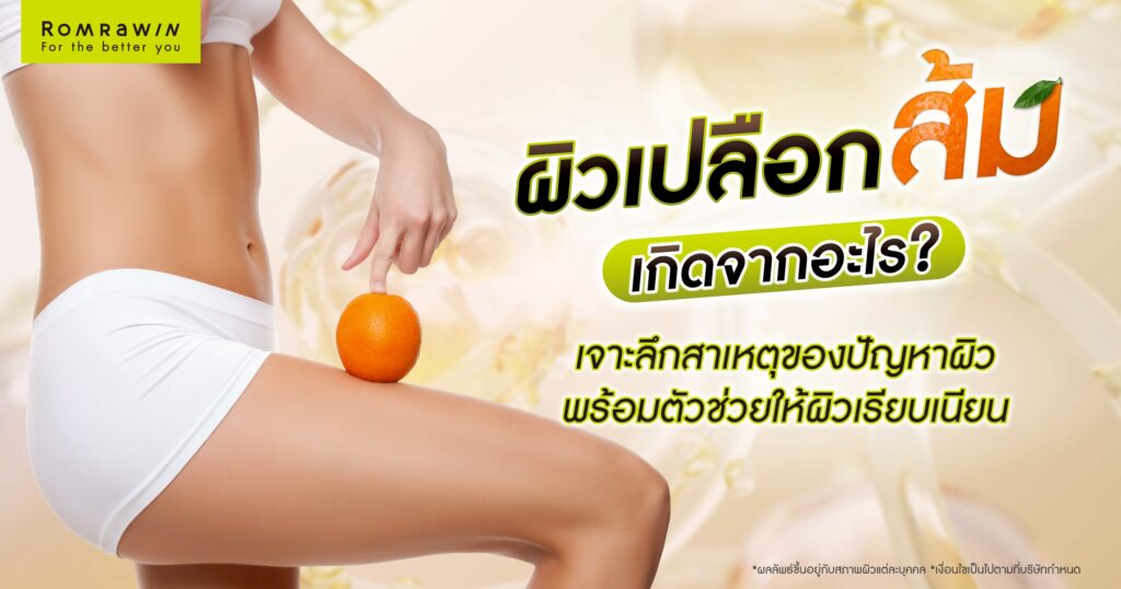 ผิวเปลือกส้ม เกิดจากอะไร? สาเหตุของปัญหาผิว พร้อมตัวช่วยให้ผิวเรียบเนียน 4 ผิวเปลือกส้ม