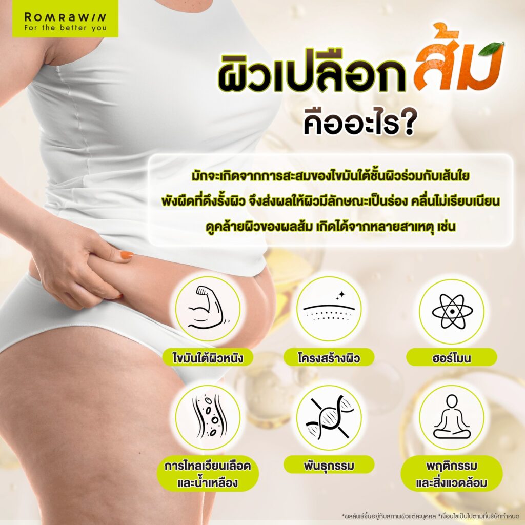 ผิวเปลือกส้ม เกิดจากอะไร? สาเหตุของปัญหาผิว พร้อมตัวช่วยให้ผิวเรียบเนียน 2 ผิวเปลือกส้ม คืออะไร?