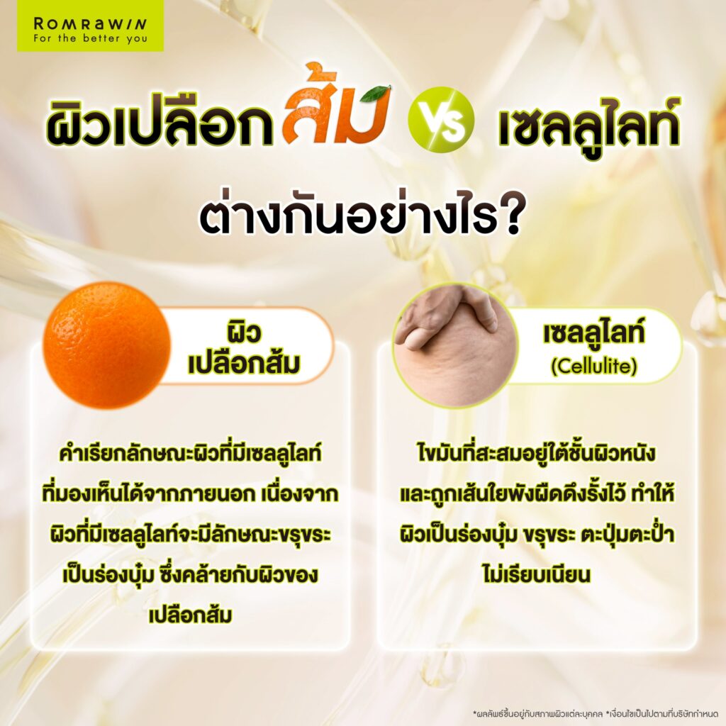ผิวเปลือกส้ม เกิดจากอะไร? สาเหตุของปัญหาผิว พร้อมตัวช่วยให้ผิวเรียบเนียน 3 ผิวเปลือกส้ม VS เซลลูไลท์ ต่างกันอย่างไร?
