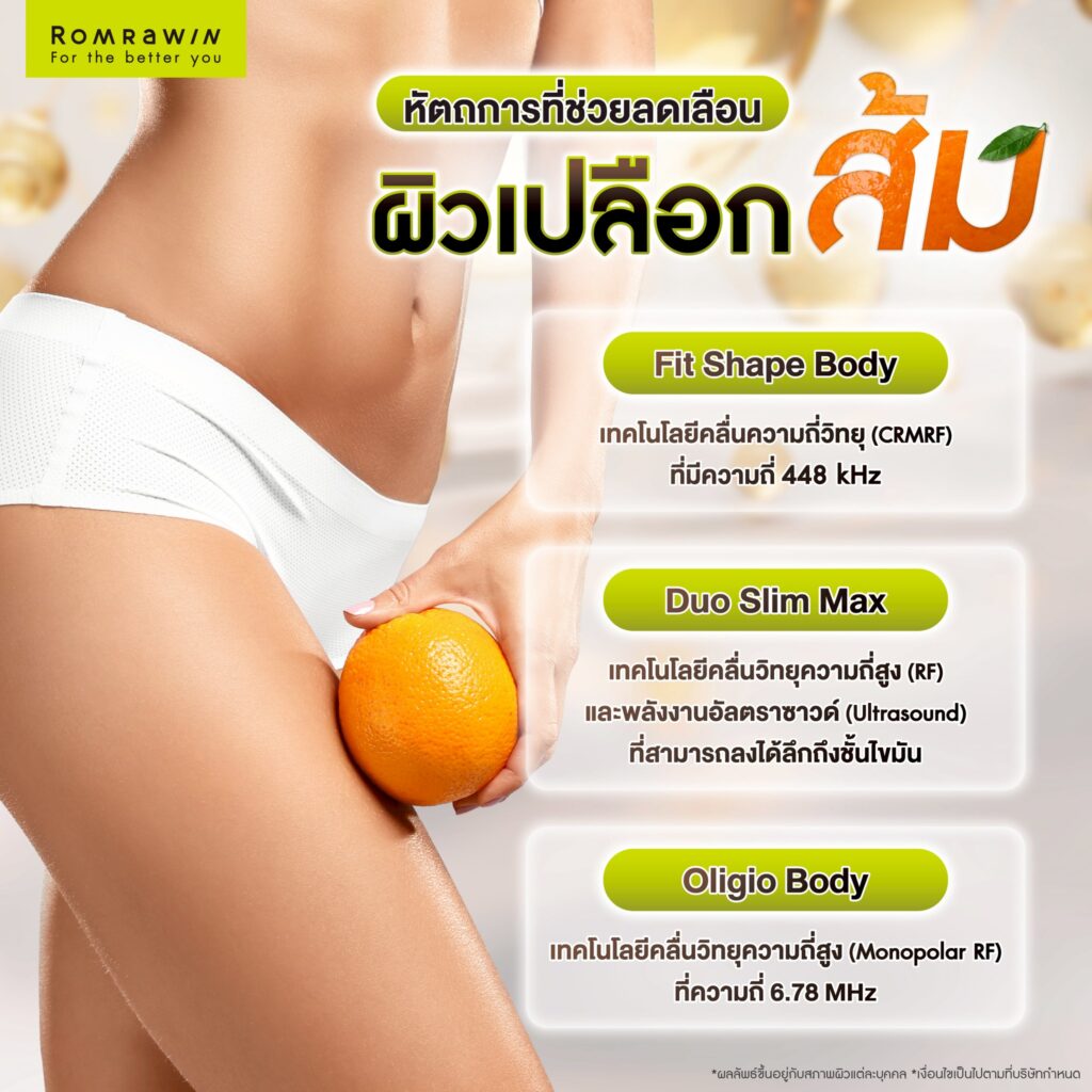 ผิวเปลือกส้ม เกิดจากอะไร? สาเหตุของปัญหาผิว พร้อมตัวช่วยให้ผิวเรียบเนียน 4 หัตถการที่ช่วยลดเลือนผิวเปลือกส้ม