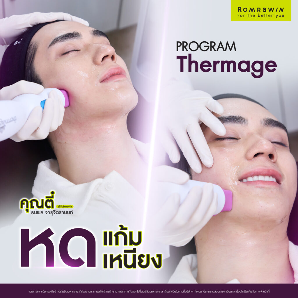 ลดเหนียง หดแก้ม ให้คุณตี๋ ด้วย Thermage 