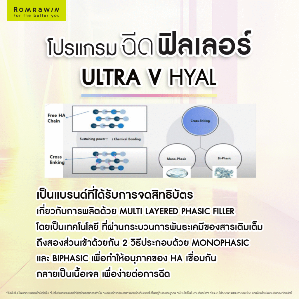 Ultra V Hyal Filler คืออะไร