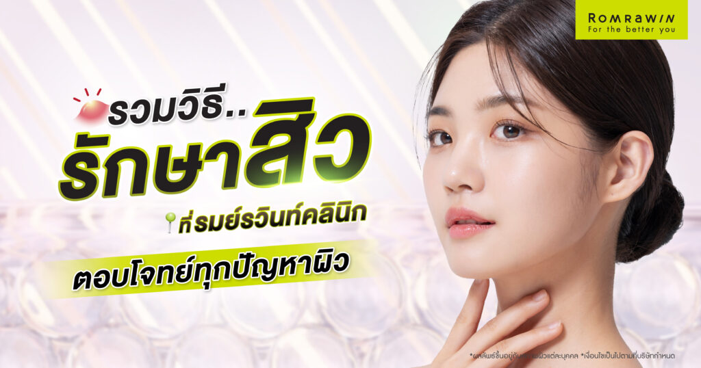 รักษาสิวที่รมย์รวินท์มีวิธีอะไรบ้าง วิธีไหนเหมาะกับใคร ดียังไง 1 รักษาสิวที่รมย์รวินท์