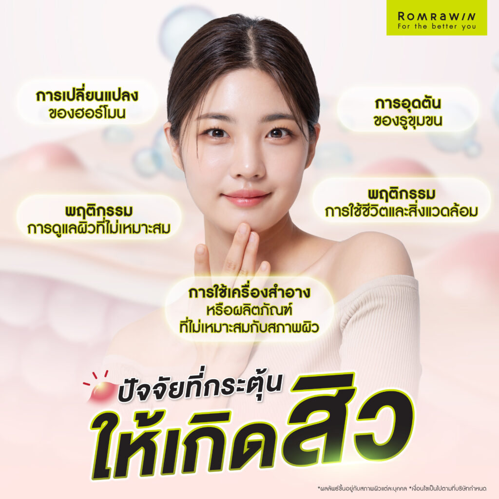 รักษาสิวที่รมย์รวินท์มีวิธีอะไรบ้าง วิธีไหนเหมาะกับใคร ดียังไง 2 ปัจจัยที่กระตุ้นให้เกิด “สิว”