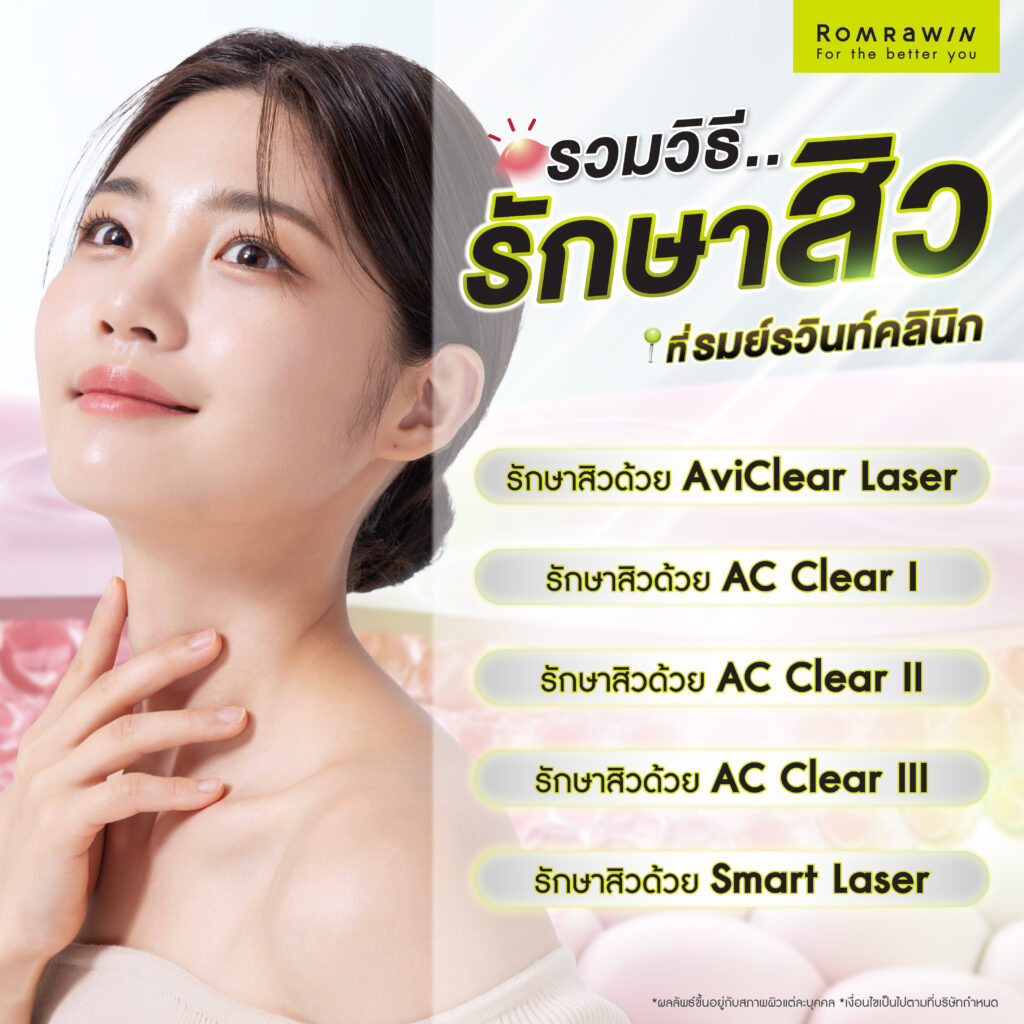 รักษาสิวที่รมย์รวินท์มีวิธีอะไรบ้าง วิธีไหนเหมาะกับใคร ดียังไง 4 1.รักษาสิวด้วย AviClear Laser