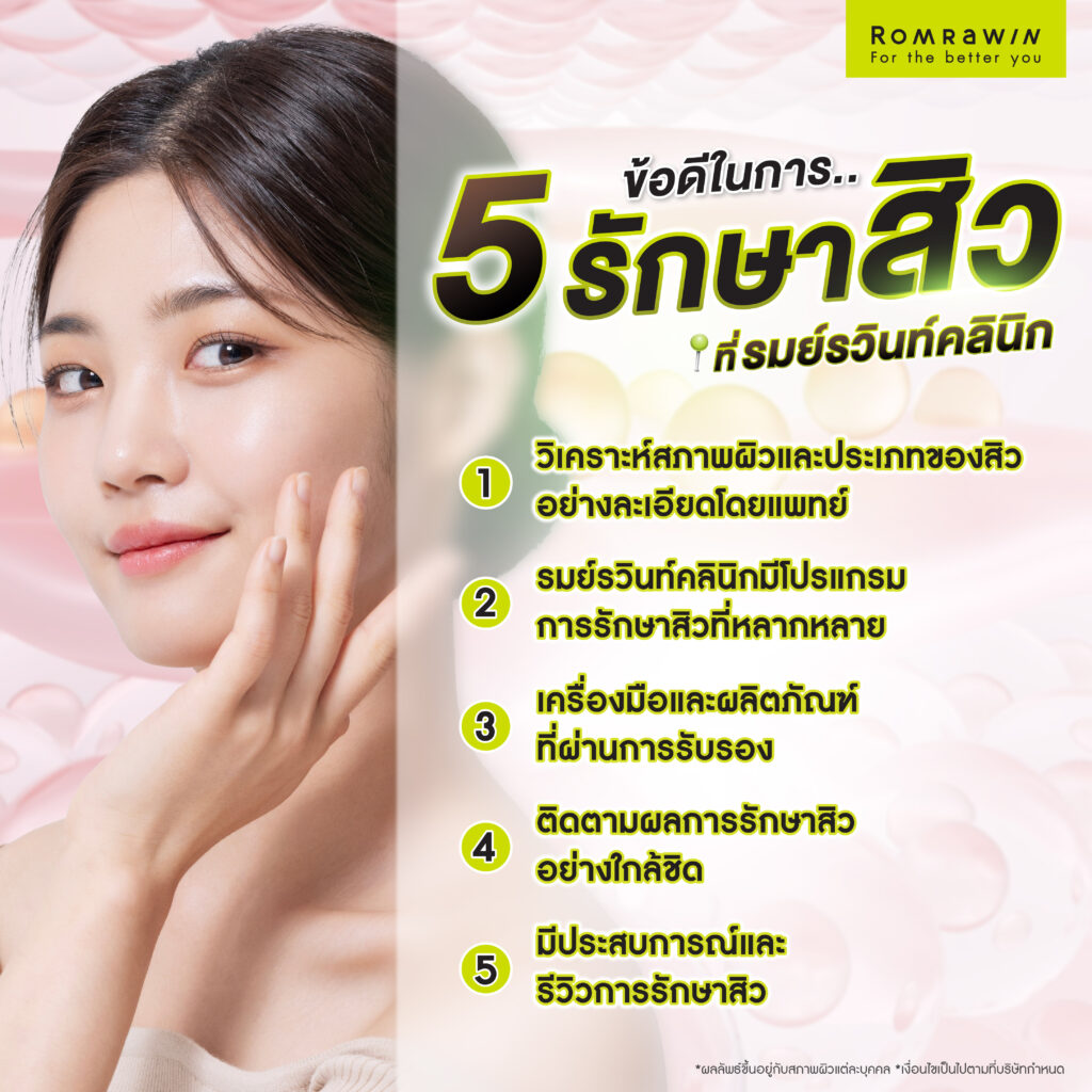 รักษาสิวที่รมย์รวินท์มีวิธีอะไรบ้าง วิธีไหนเหมาะกับใคร ดียังไง 5 รักษาสิวที่รมย์รวินท์คลินิกดีอย่างไร ?