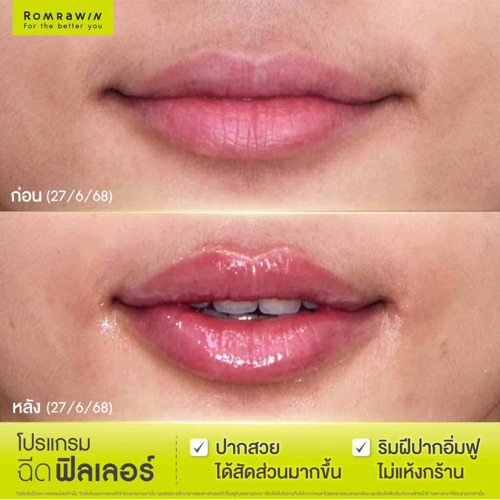 ปากใหม่ฉ่ำ อิ่มฟู..ดูน่าจุ๊บ คุณอริส อริสรา 3 ปากใหม่ฉ่ำ อิ่มฟู..ดูน่าจุ๊บ คุณอริส อริสรา