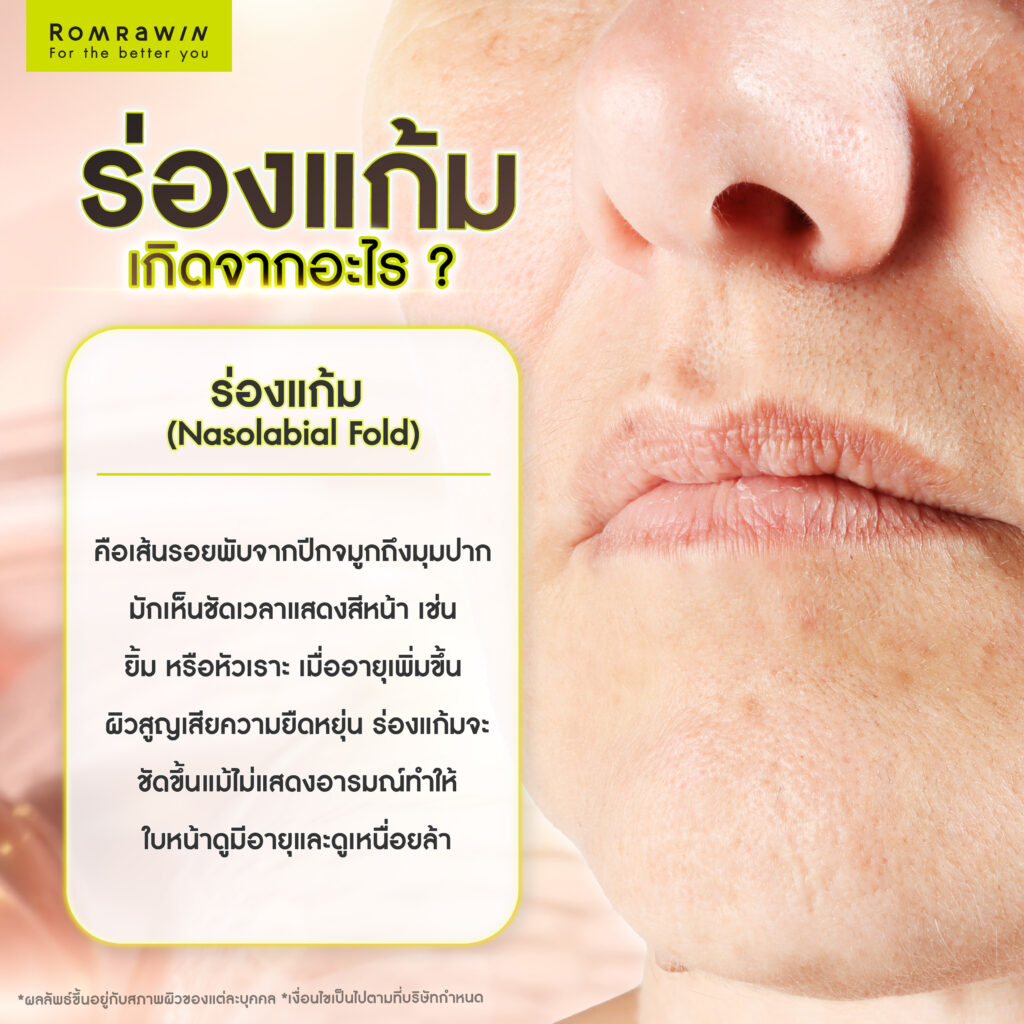 กระชับร่องแก้มด้วยวิธีไหนดีกว่ากัน เครื่องยกกระชับ vs ฟิลเลอร์ 2 ร่องแก้มเกิดจากอะไร?