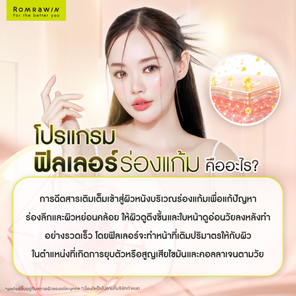 กระชับร่องแก้มด้วยวิธีไหนดีกว่ากัน เครื่องยกกระชับ vs ฟิลเลอร์ 4 ฟิลเลอร์ร่องแก้ม คืออะไร?