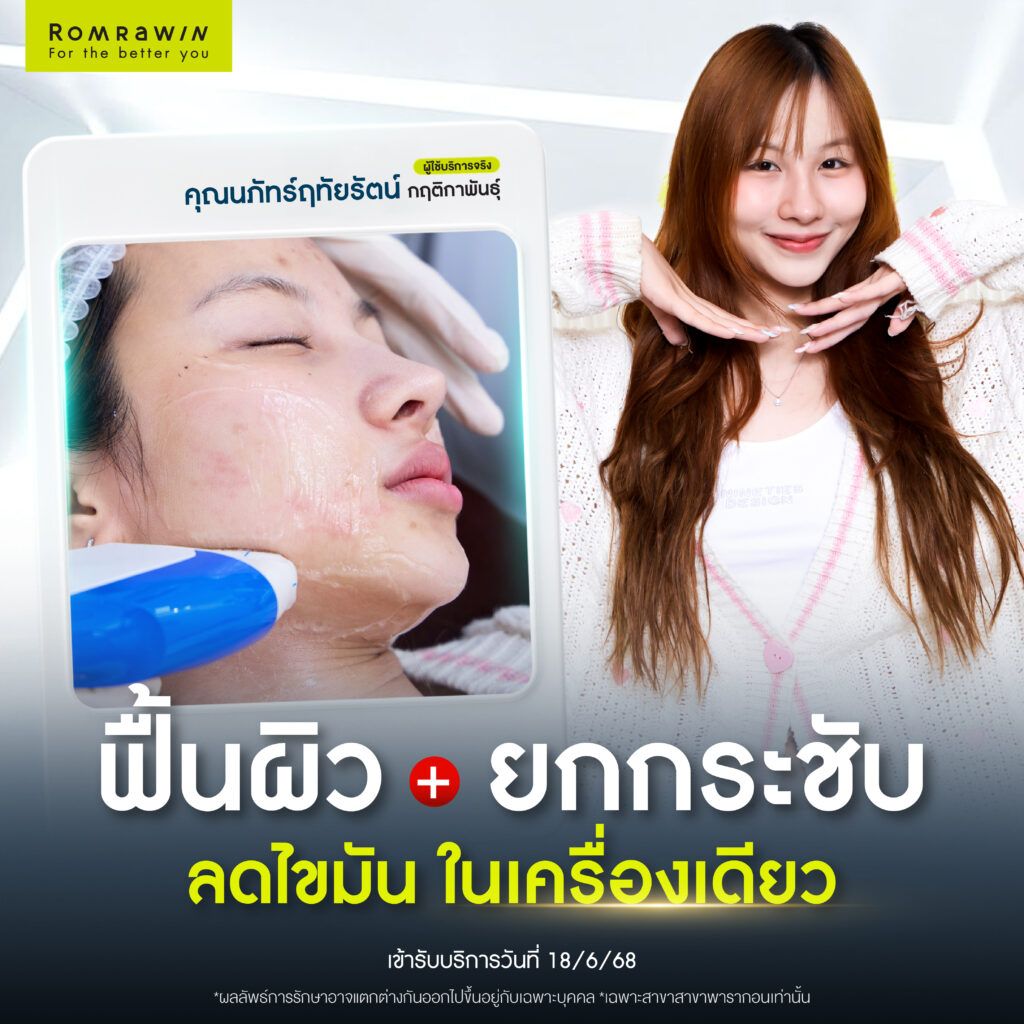 ลาก่อนแก้มอ้วน เพราะ Ultraformer MPT 4D  LIFT ช่วยจัดการให้หน้าเรียว 