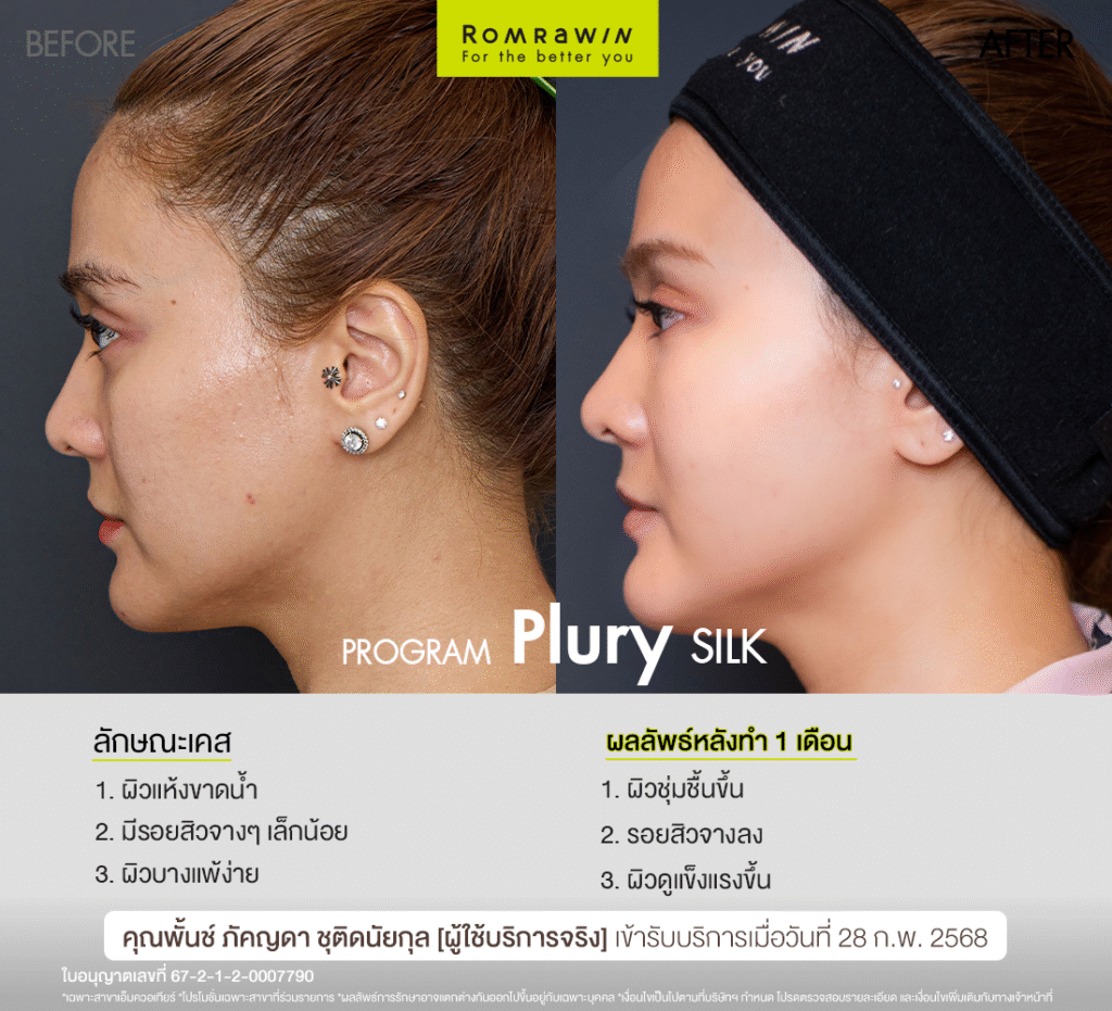 Plury SILK คุณพั้นช์ช่วยกู้ผิวหน้าคุณพั้นช์ให้สวย แข็งแรง สุขภาพดี