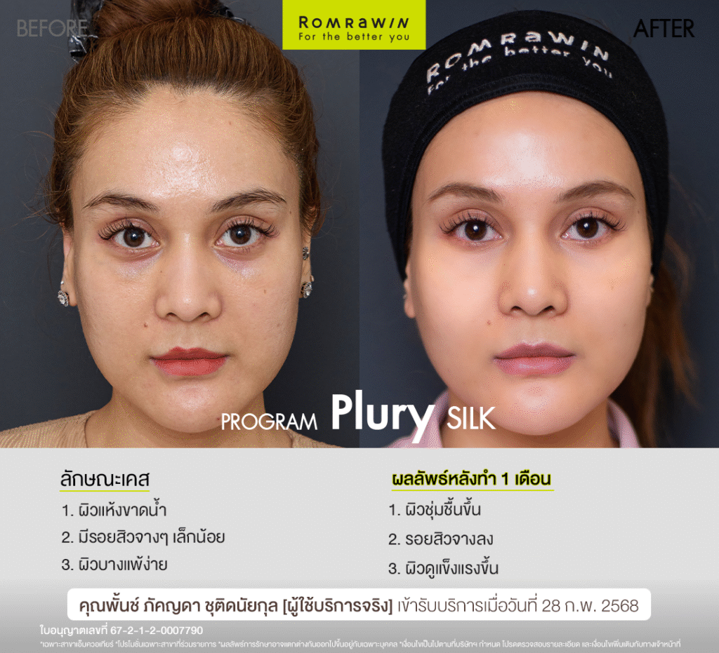 Plury SILK คุณพั้นช์ช่วยกู้ผิวหน้าคุณพั้นช์ให้สวย แข็งแรง สุขภาพดี