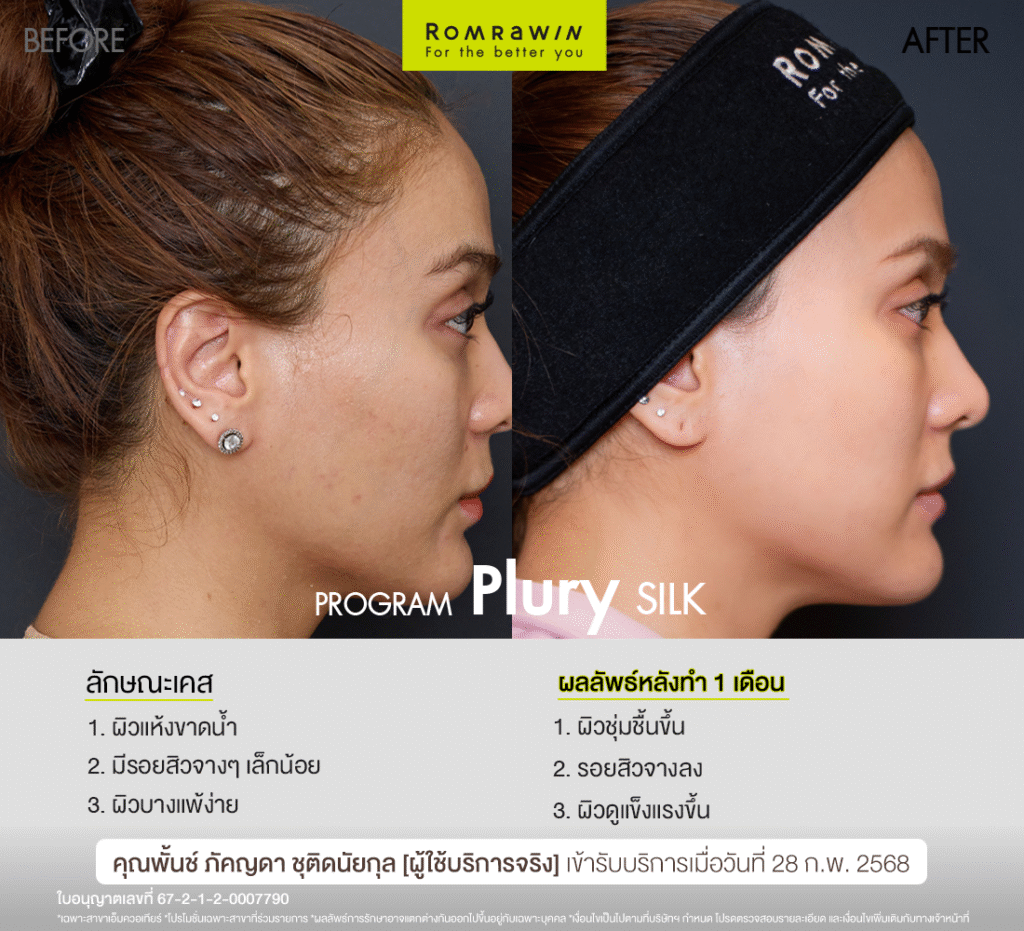 Plury SILK คุณพั้นช์ช่วยกู้ผิวหน้าคุณพั้นช์ให้สวย แข็งแรง สุขภาพดี