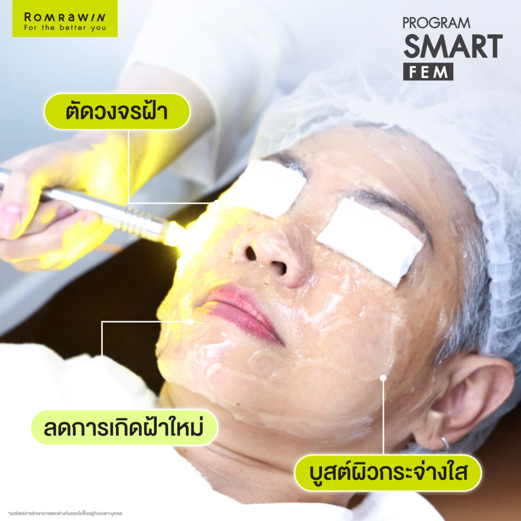 SMART FEM และ MAGICA YOUNG WHITE คุณฝน สิรินธร 3 SMART FEM คุณฝน สิรินธร
