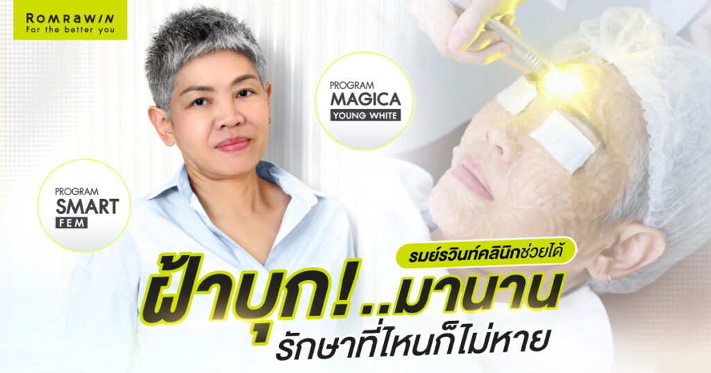 SMART FEM และ MAGICA YOUNG WHITE คุณฝน สิรินธร
