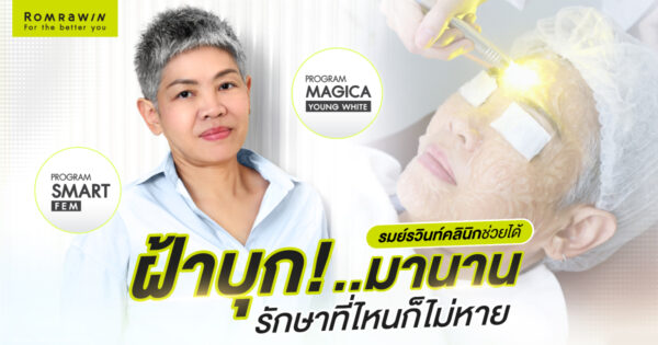 SMART FEM และ MAGICA YOUNG WHITE คุณฝน สิรินธร