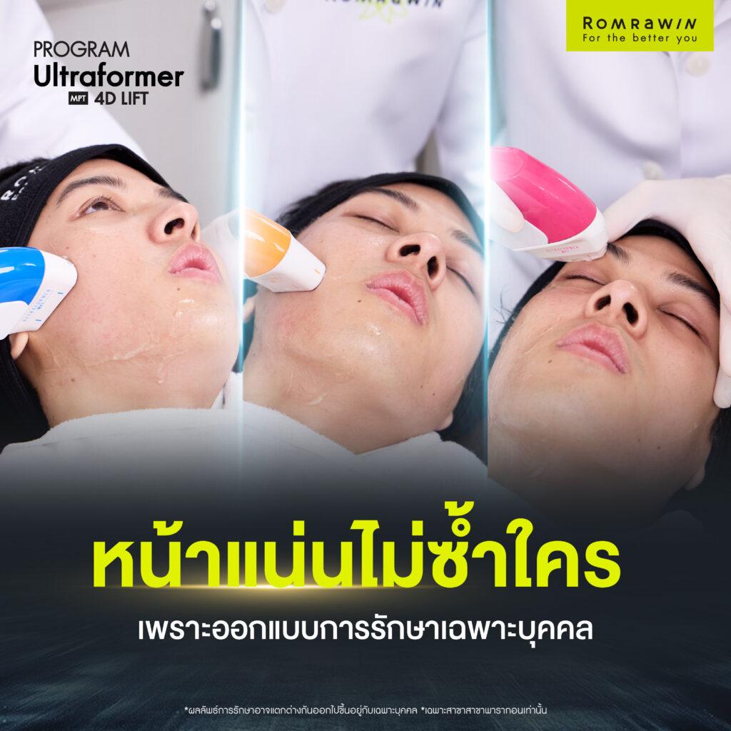 คุณตังโก้ Ultraformer MPT 4D LIFT กรอบหน้าชัดแบบผู้ชายสมัยใหม่ 