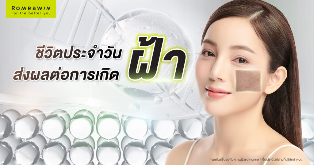 ชีวิตประจำวัน ส่งผลต่อการเกิดฝ้าอย่างไร 5 ชีวิตประจำวัน ส่งผลต่อการเกิดฝ้าอย่างไร