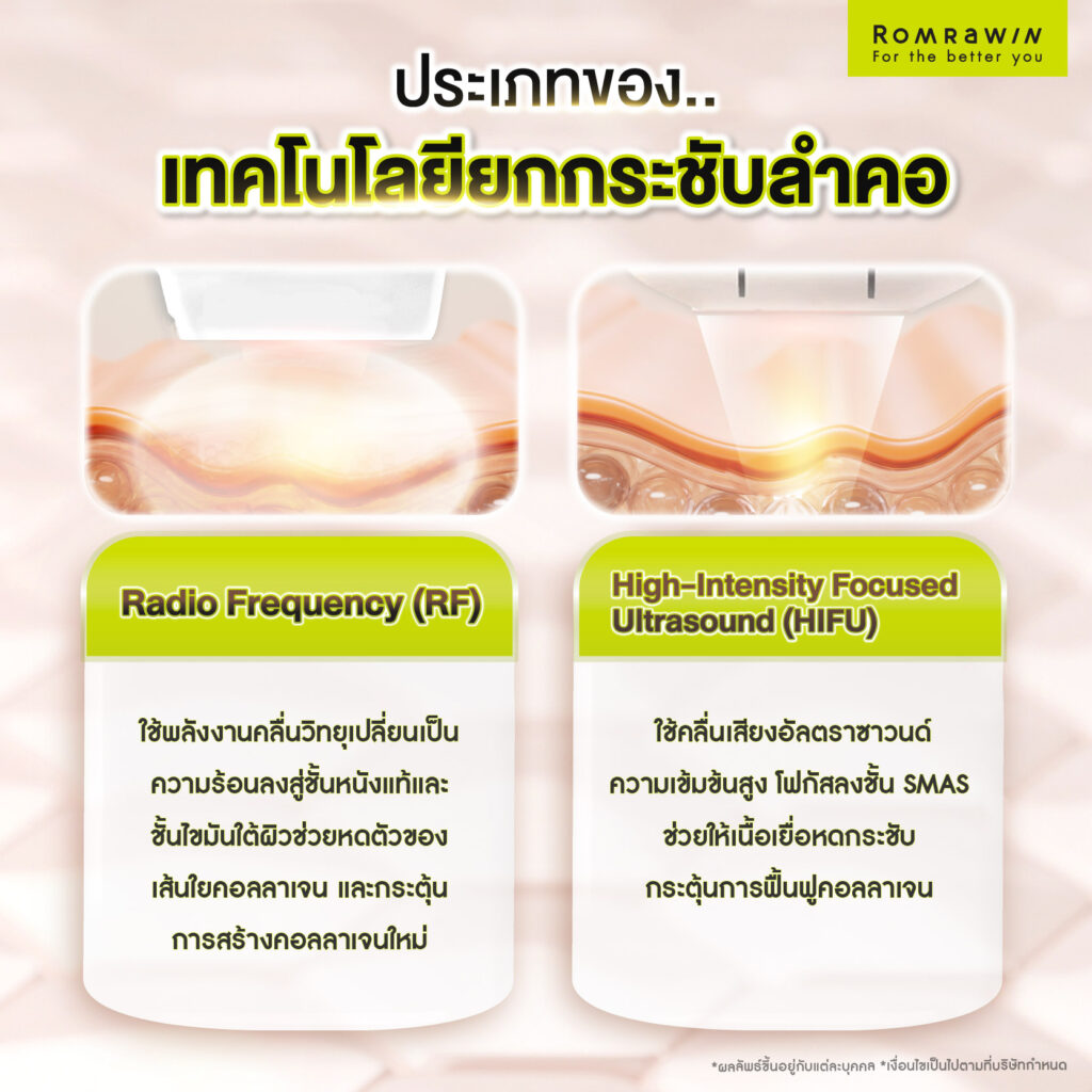 ประเภทของเทคโนโลยีเครื่องยกกระชับลำคอ