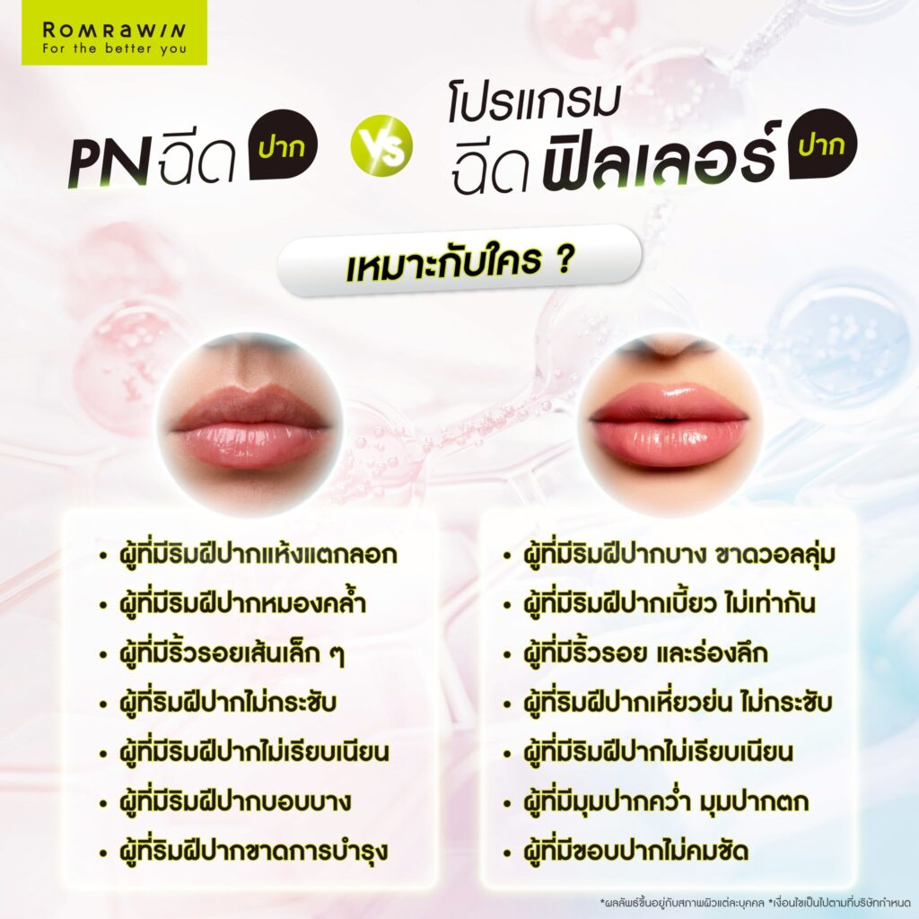 PN ฉีดปาก กับ ฉีดฟิลเลอร์ปาก เหมาะสำหรับใคร?