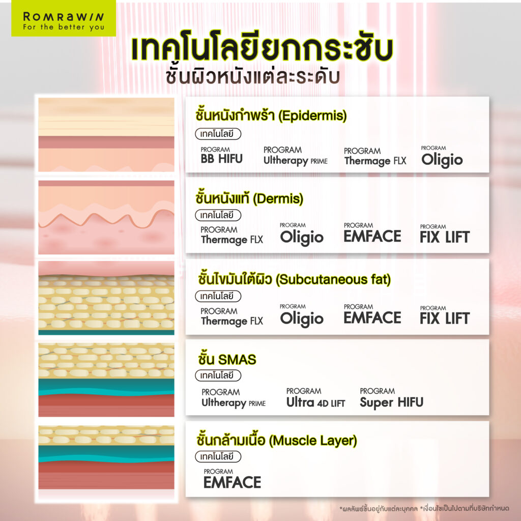 เทคโนโลยียกกระชับชั้นผิวหนังแต่ละระดับ