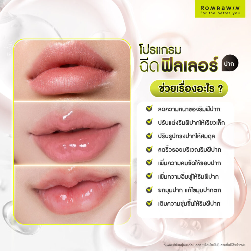 ฉีดฟิลเลอร์ปากช่วยเรื่องอะไร?