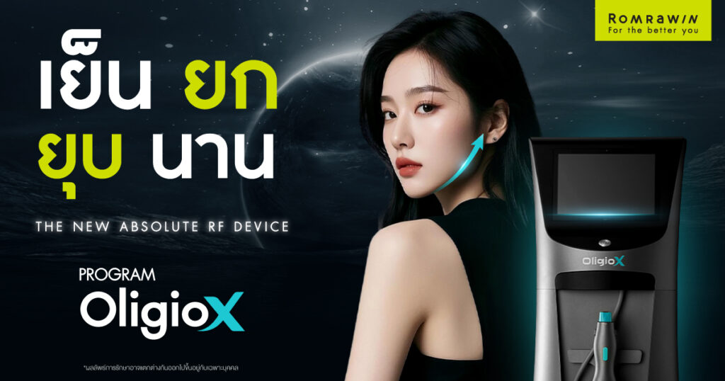 OligioX เทคโนโลยี RF ยกกระชับผิวลึกถึงชั้นไขมัน รุ่นใหม่ล่าสุดจาก Oligio 2 oligiox เย็น ยก ยุบ นาน