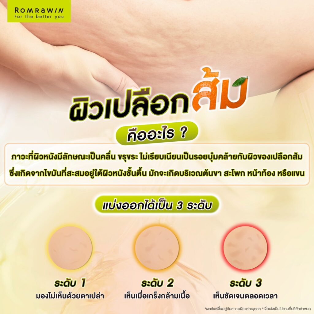 ผิวเปลือกส้ม คืออะไร? 