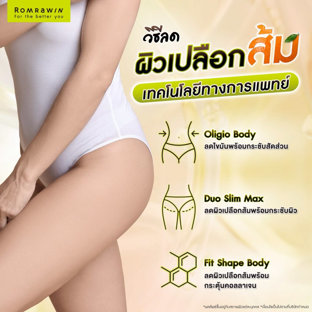 วิธีลดผิวเปลือกส้มด้วยเทคโนโลยีทางการแพทย์