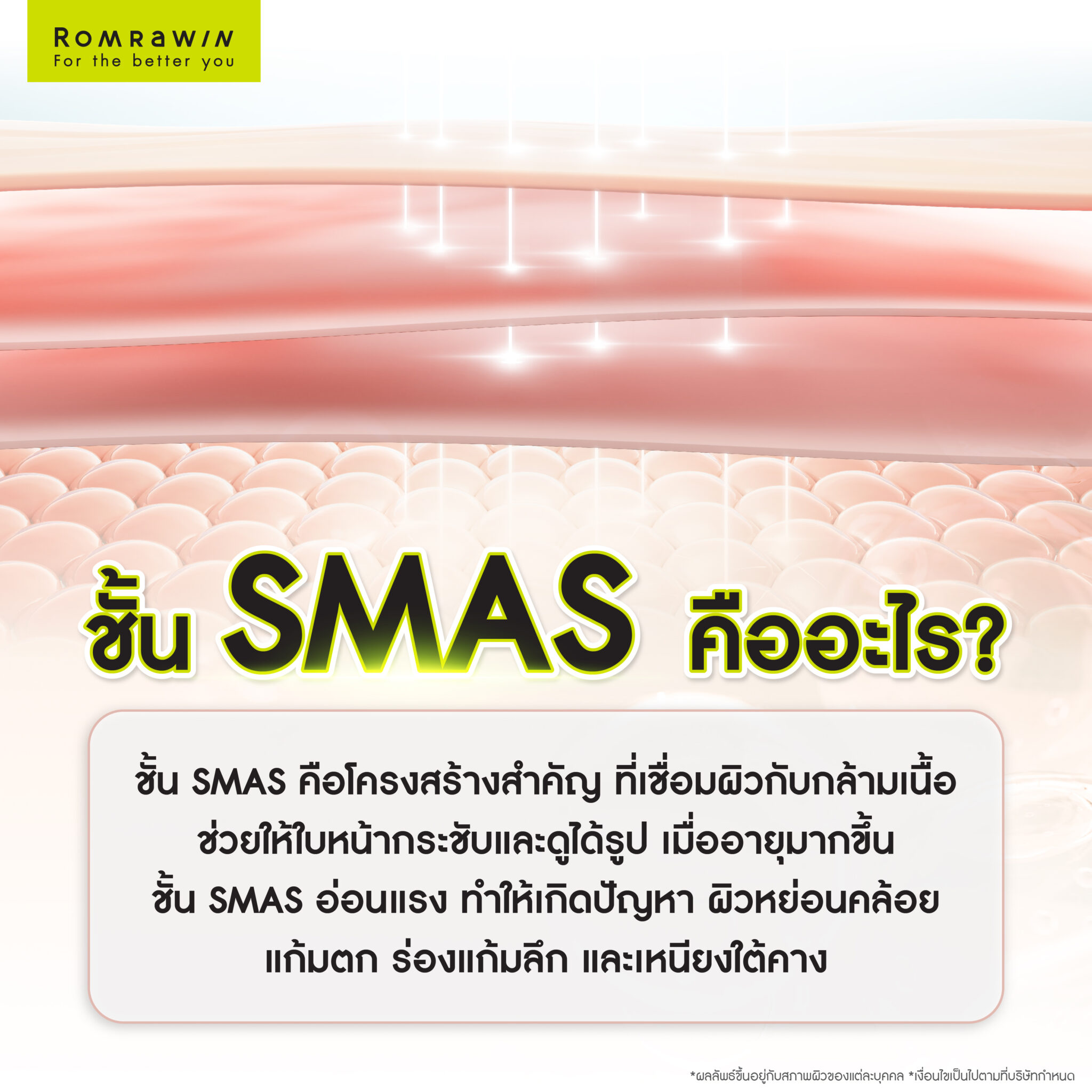 ชั้น SMAS คืออะไร? สำคัญอย่างไรในการยกกระชับ ไม่ทำต้องยกกระชับชั้น SMAS